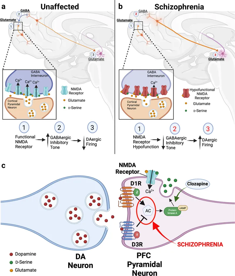 Dopamine and glutamate pathways in schizophrenia
