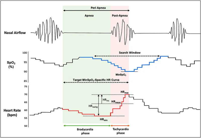 Apnea event: airflow, SpO2, heart rate