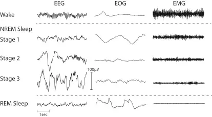 EEG, EOG, and EMG Waveforms During Sleep Stages