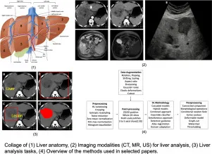 AI in Abdominal Imaging: Liver Analysis