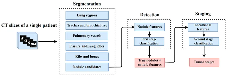 AI workflow for pulmonary nodule detection