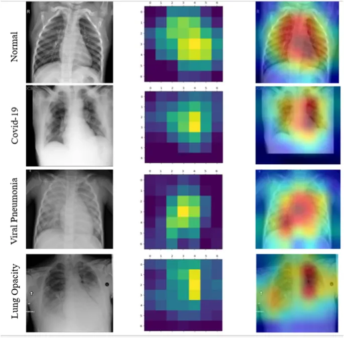 AI heatmaps on CXRs for normal, COVID-19, pneumonia, opacity