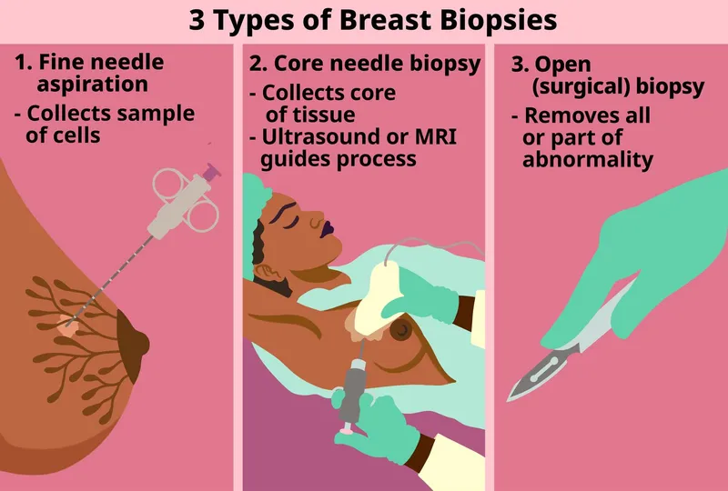3 Types of Breast Biopsies
