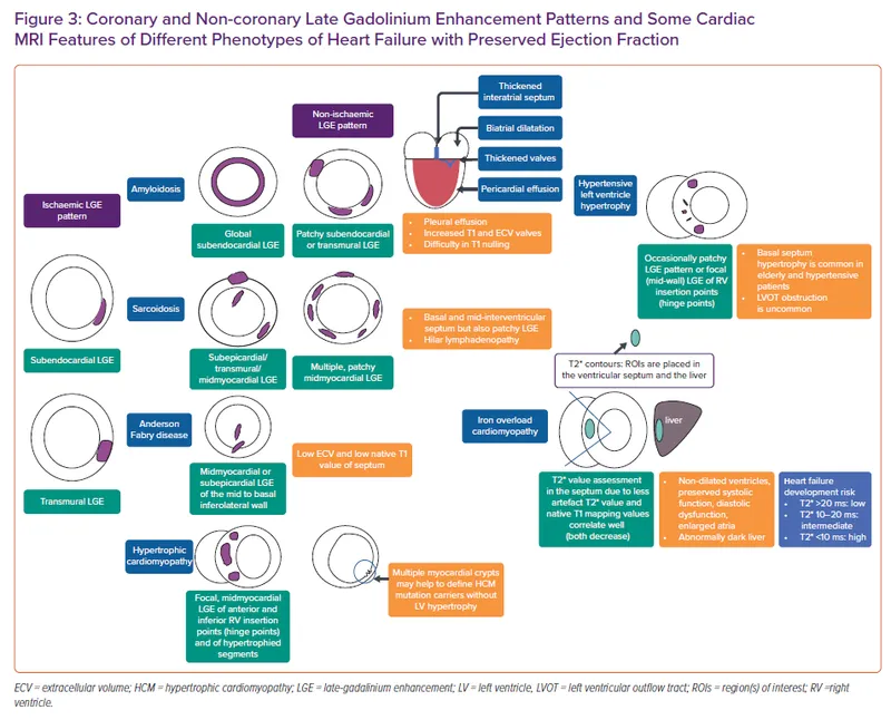 Cardiac MRI LGE patterns in heart failure