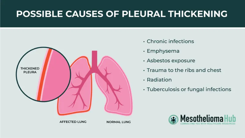 Possible causes of pleural thickening