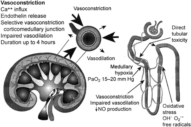 Pathophysiology of Contrast-Induced Nephropathy
