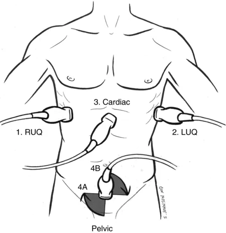 FAST scan standard views and probe placement