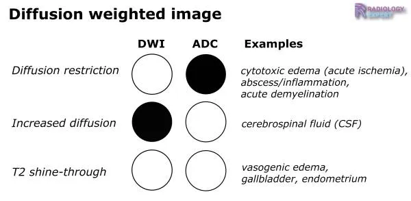 DWI and ADC signal characteristics and examples