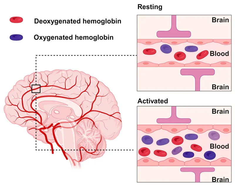 BOLD effect in fMRI: Resting vs. Activated Brain