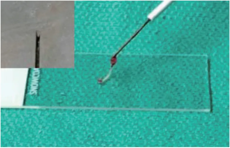 Core biopsy needle with tissue sample