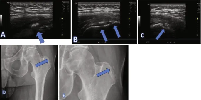 MSK US: Anisotropy, shadowing, and enhancement