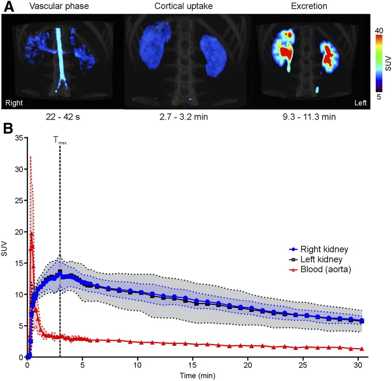 Renal nuclear medicine phases and renogram
