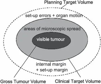 Tumor Volumes in Radiation Therapy Planning