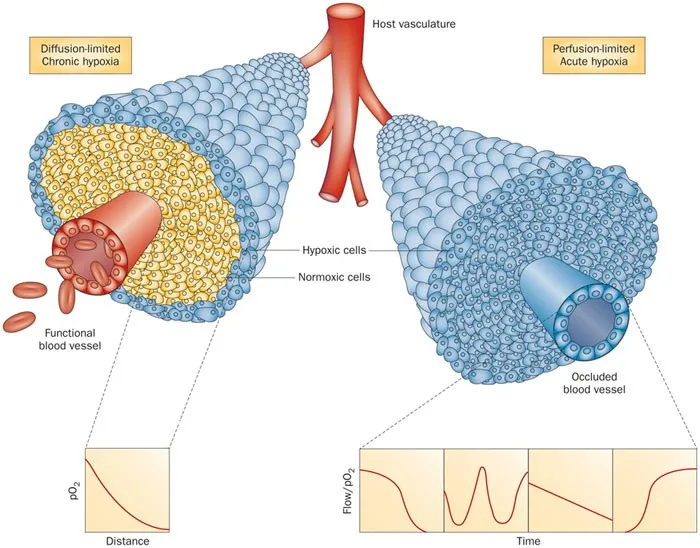 Chronic vs Acute Tumor Hypoxia