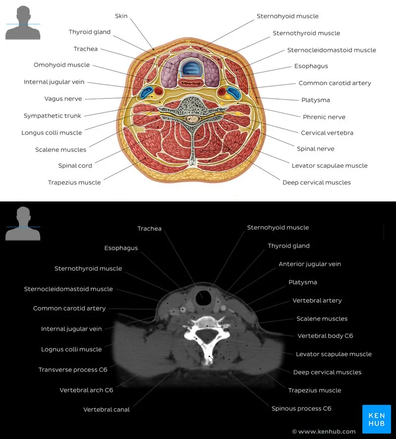 Axial neck anatomy: illustration vs. CT scan