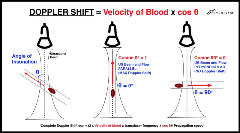 Doppler shift and angle of insonation