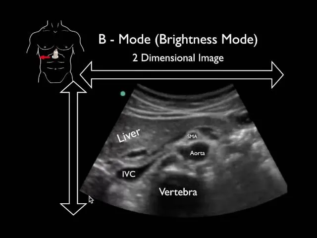 B-Mode Ultrasound Image with Labels