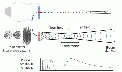 Ultrasound Beam Zones and Transducer Components