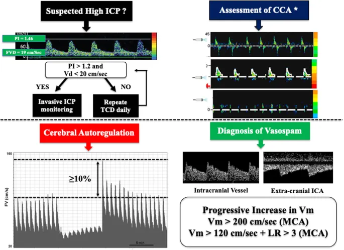 TCD waveform analysis for high ICP and vasospasm