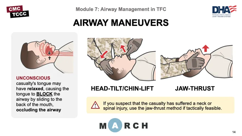 Airway Maneuvers: Head-Tilt/Chin-Lift vs. Jaw-Thrust