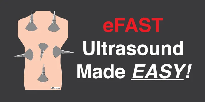eFAST exam probe positions for trauma ultrasound
