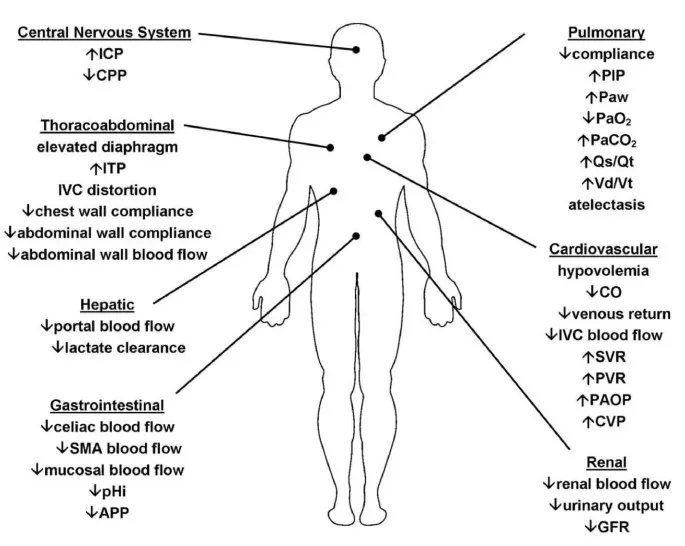 Organ dysfunction in abdominal compartment syndrome