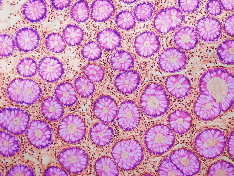 Colon histology: crypts of Lieberkühn and goblet cells