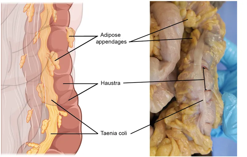 Colon anatomy: haustra, taenia coli, appendices epiploicae