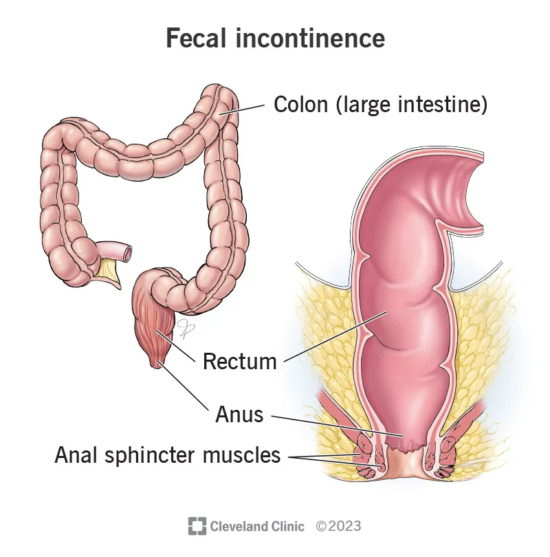 Anatomy of the colon, rectum, anus, and anal sphincter