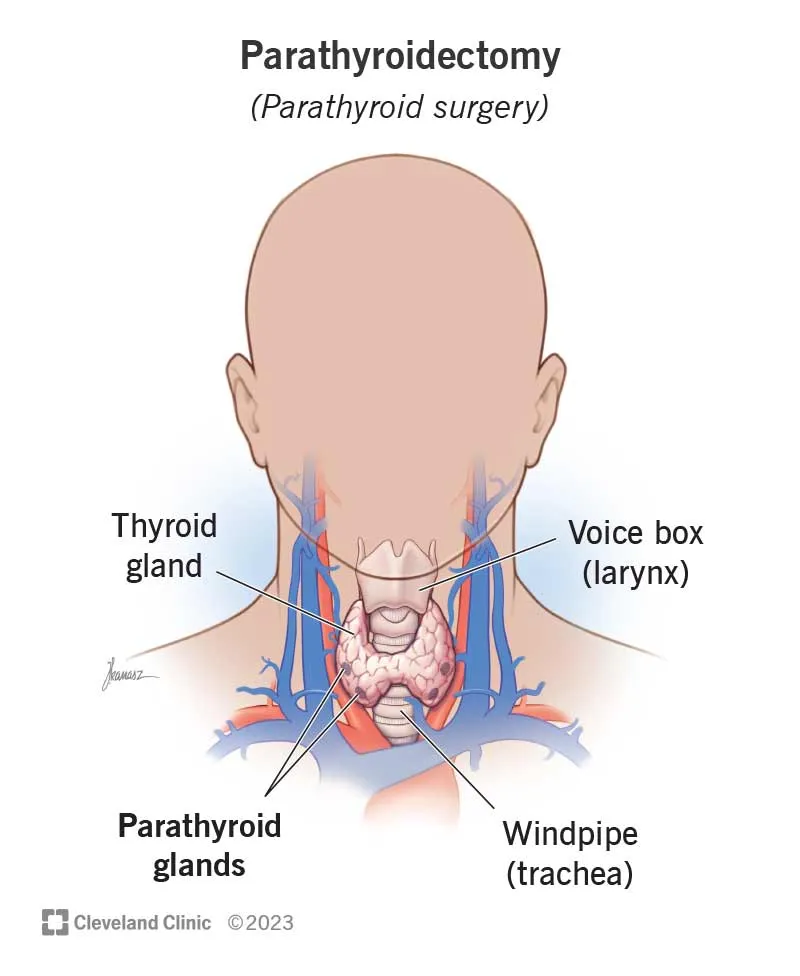 Parathyroidectomy: Anatomy of the parathyroid glands