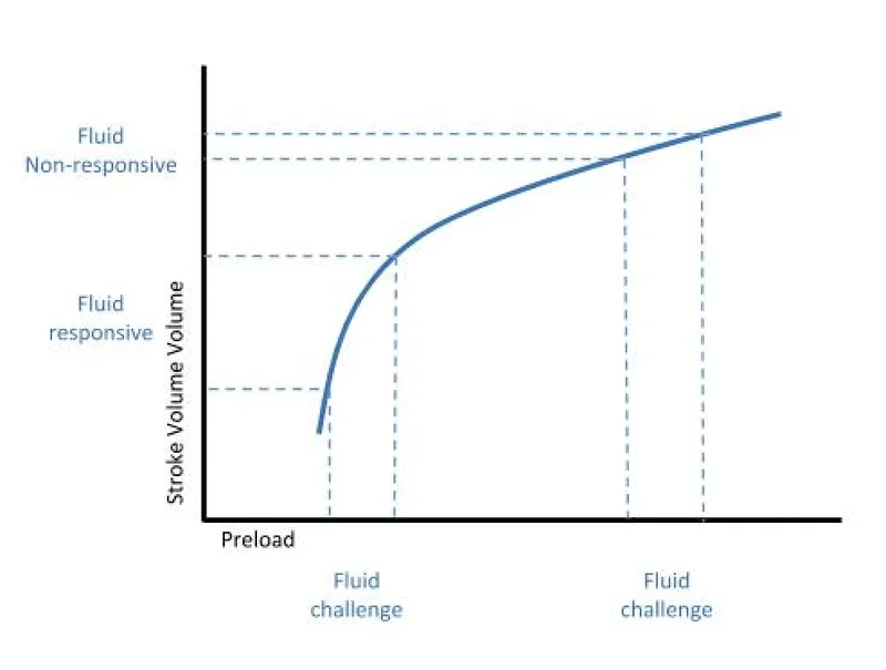 Frank-Starling curve: fluid responsiveness and preload
