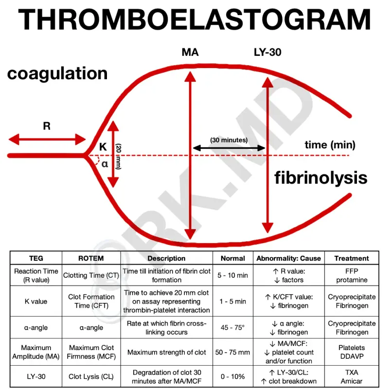 Thromboelastogram (TEG) Interpretation Diagram