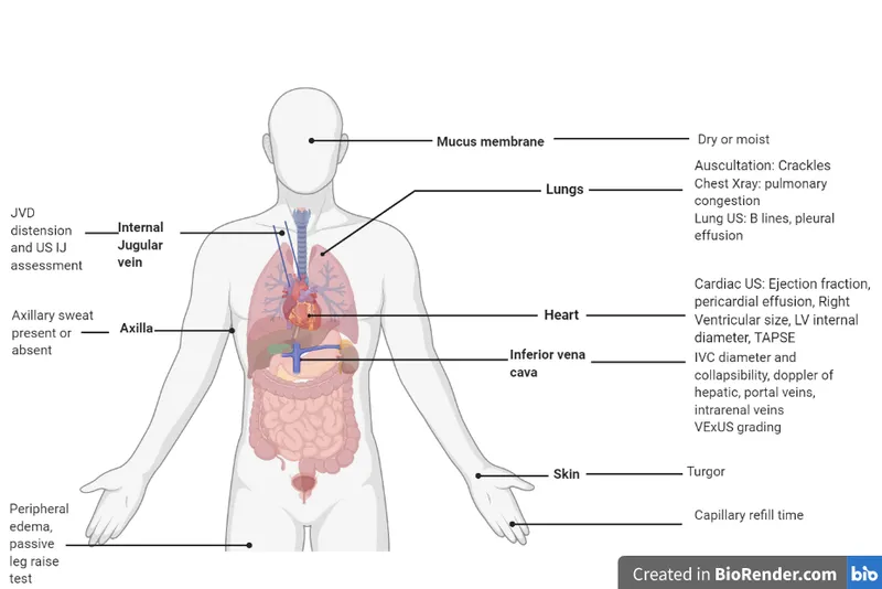 Clinical assessment of fluid status