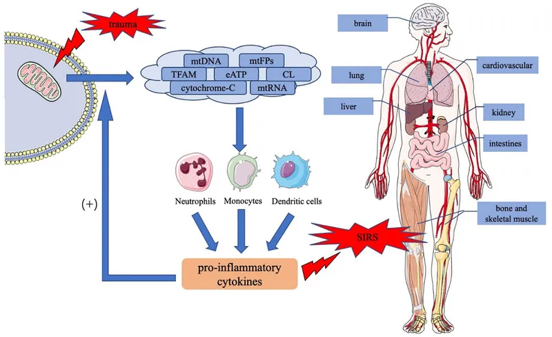 SIRS pathway from trauma to systemic inflammation