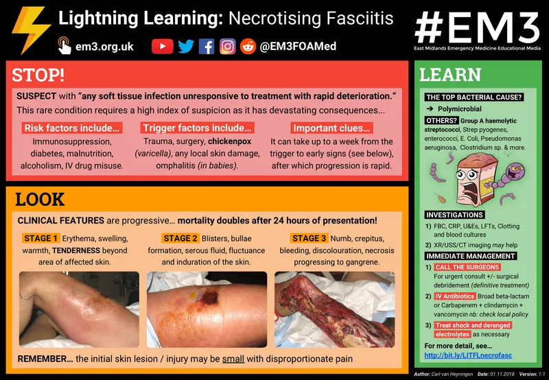 Necrotizing Fasciitis: Stages and Management