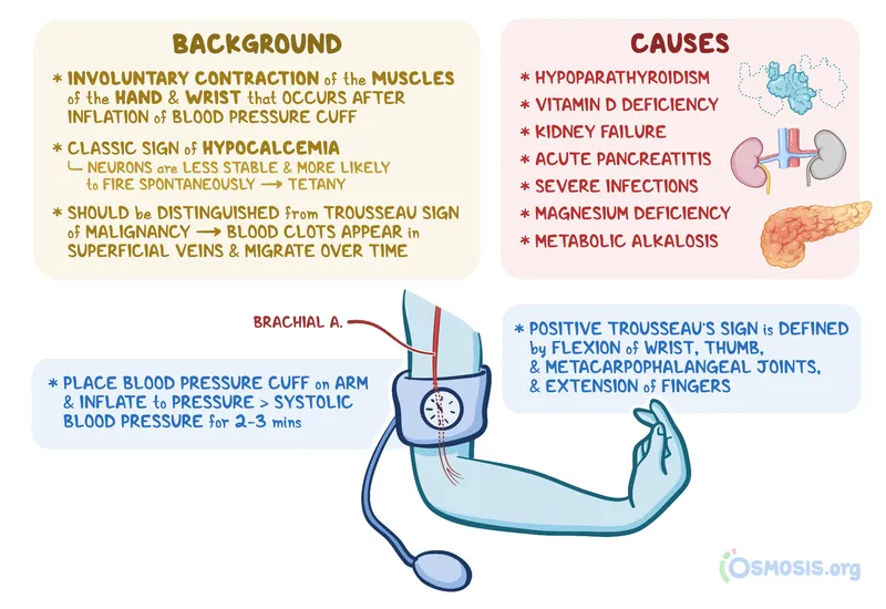 Trousseau's sign: Causes and clinical illustration