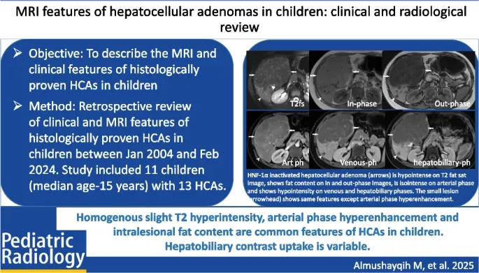 MRI of hepatocellular adenoma in child