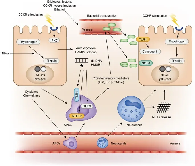 Pathophysiology of Acute Pancreatitis