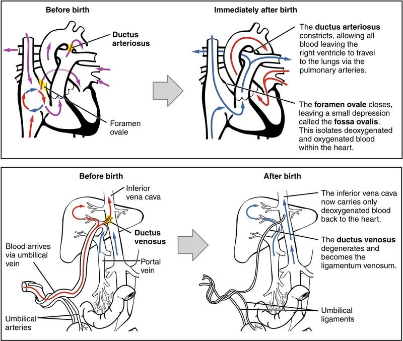 Fetal to Neonatal Circulation Changes