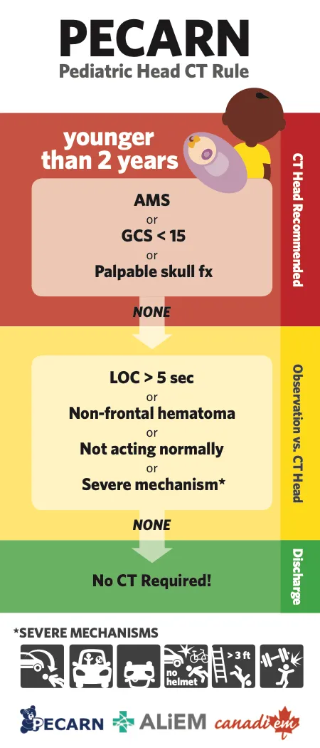 PECARN Pediatric Head CT Rule Algorithm