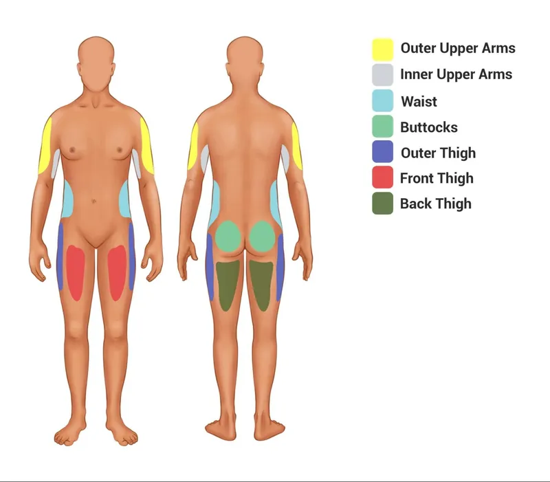 Common Body Contouring Areas