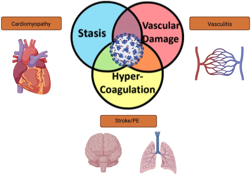 Virchow's Triad and associated conditions