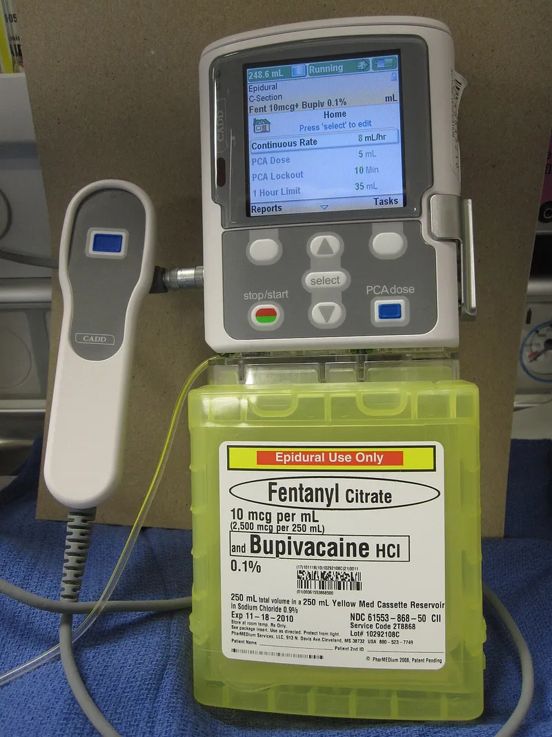 Epidural PCA pump and medication