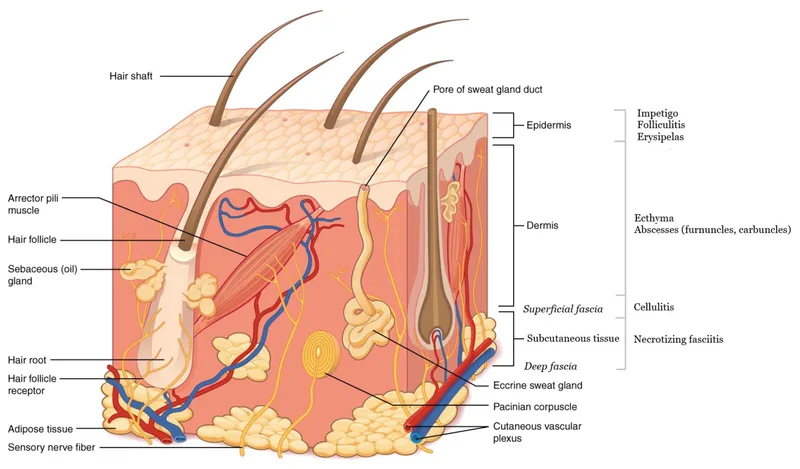 Skin layers and depth of soft tissue infections