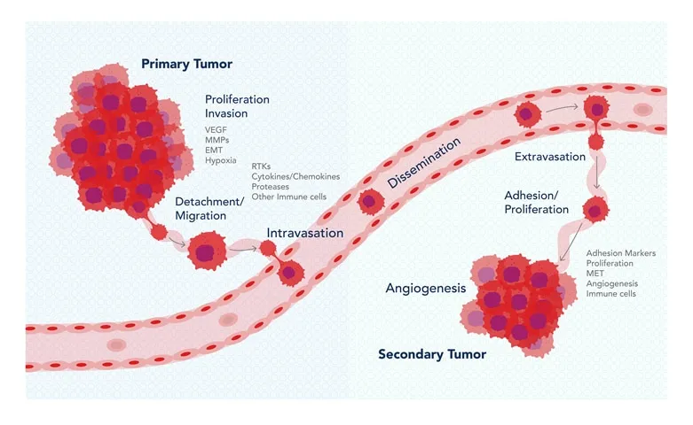 Tumor Metastasis Cascade