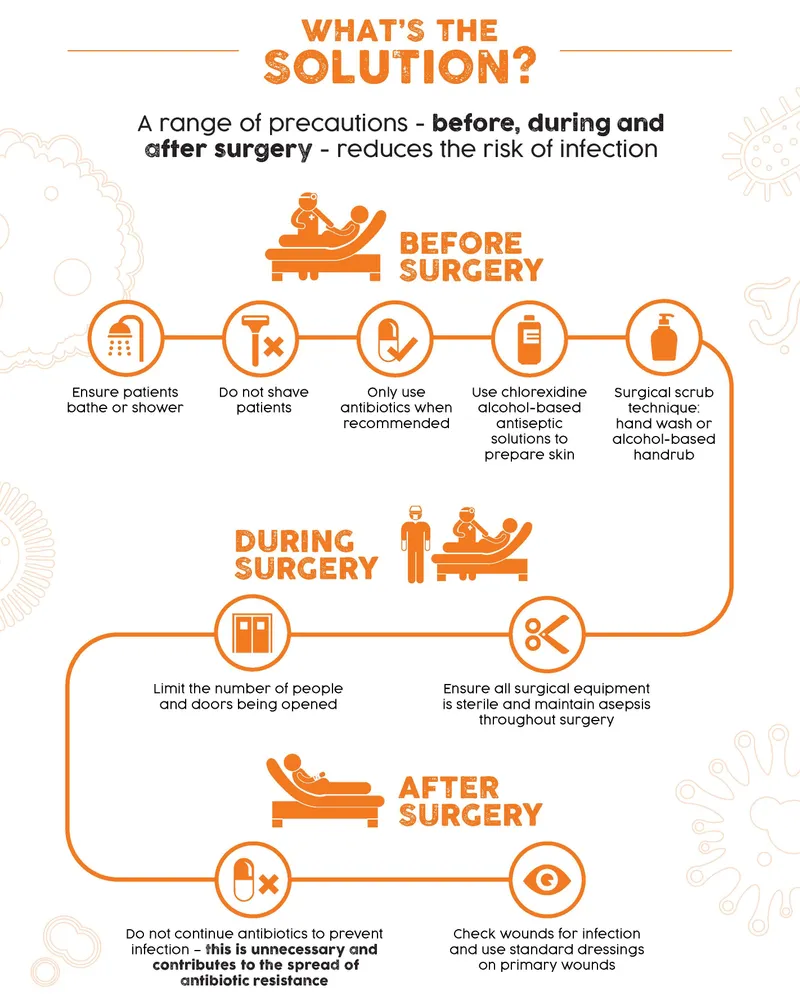 Surgical Site Infection Prevention Timeline