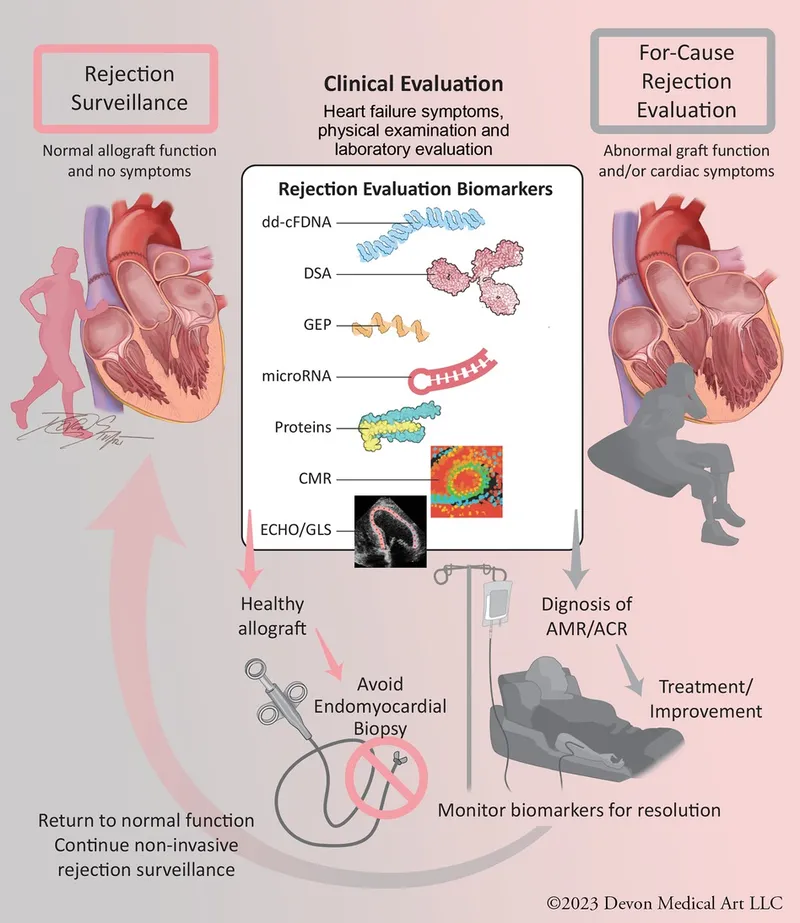 Heart Transplant Rejection Evaluation