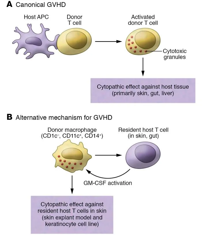 Mechanisms of Graft-Versus-Host Disease (GVHD)