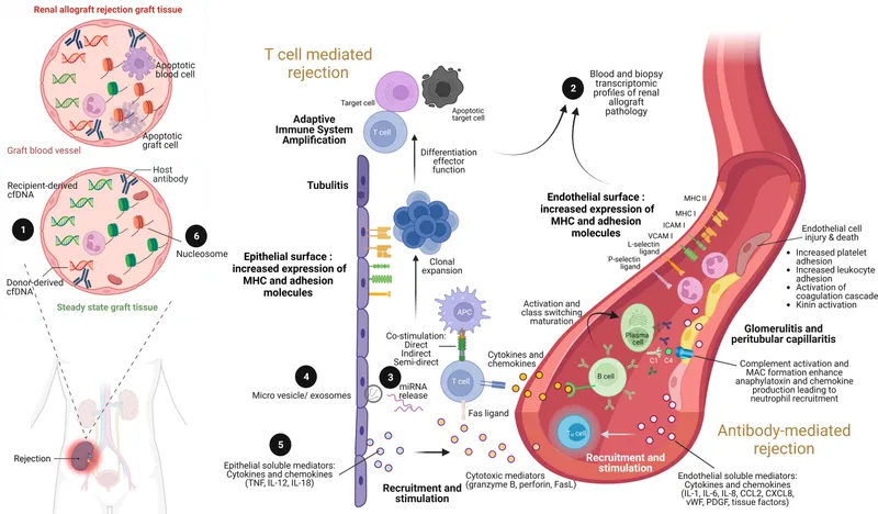 Kidney transplant rejection mechanisms