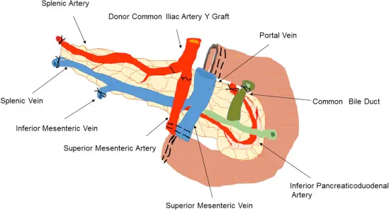 Pancreatic Graft Anatomy and Vascular Connections
